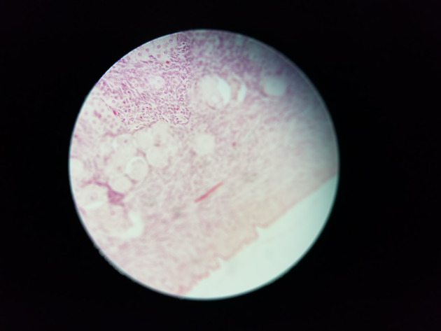 Ovary Slides - Ovary 011 400X